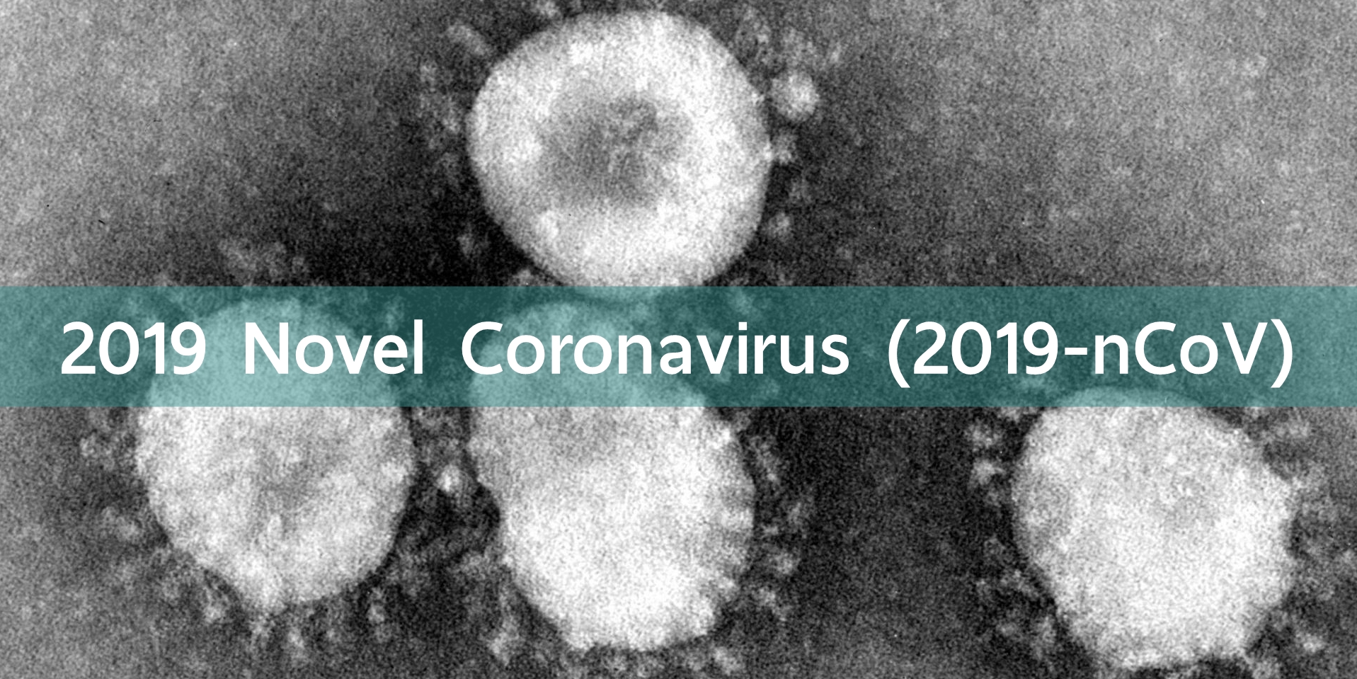 4 ก.พ. ไทยพบผู้ป่วยติดเชื้อไวรัสโคโรนาเพิ่มอีก 6 คน รวมผู้ป่วยสะสม 25 คน