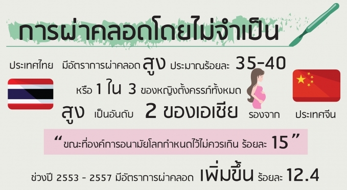 เผยหญิงไทยผ่าคลอดโดยไม่จำเป็นถึง 40% สูงเป็นอันดับ 2 ของเอเชียรองจากจีน