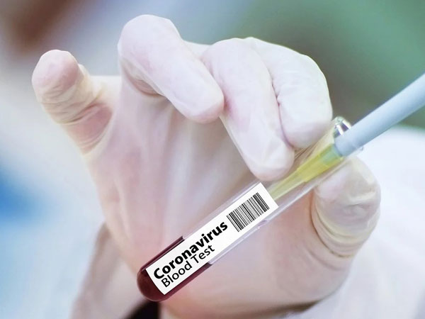นักวิจัยสิงคโปร์เตรียมทดลองวัคซีนป้องกัน COVID-19 ในคลินิกภายในประเทศเดือนหน้า